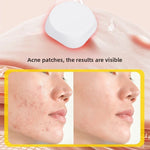 Red Blue Light Acne Removal Patch